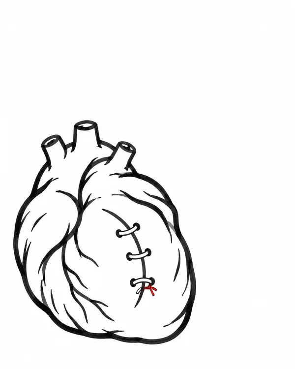 A squat, lopsided anatomical heart is drawn in thick black marker on a white background, with three short vessel stubs and a curved front seam closed by three…